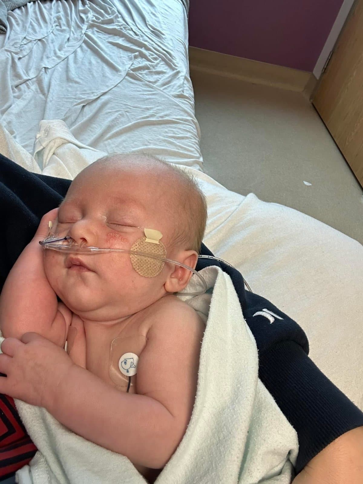 Maverick asleep in someone’s arms with a nasal cannula and monitor lead